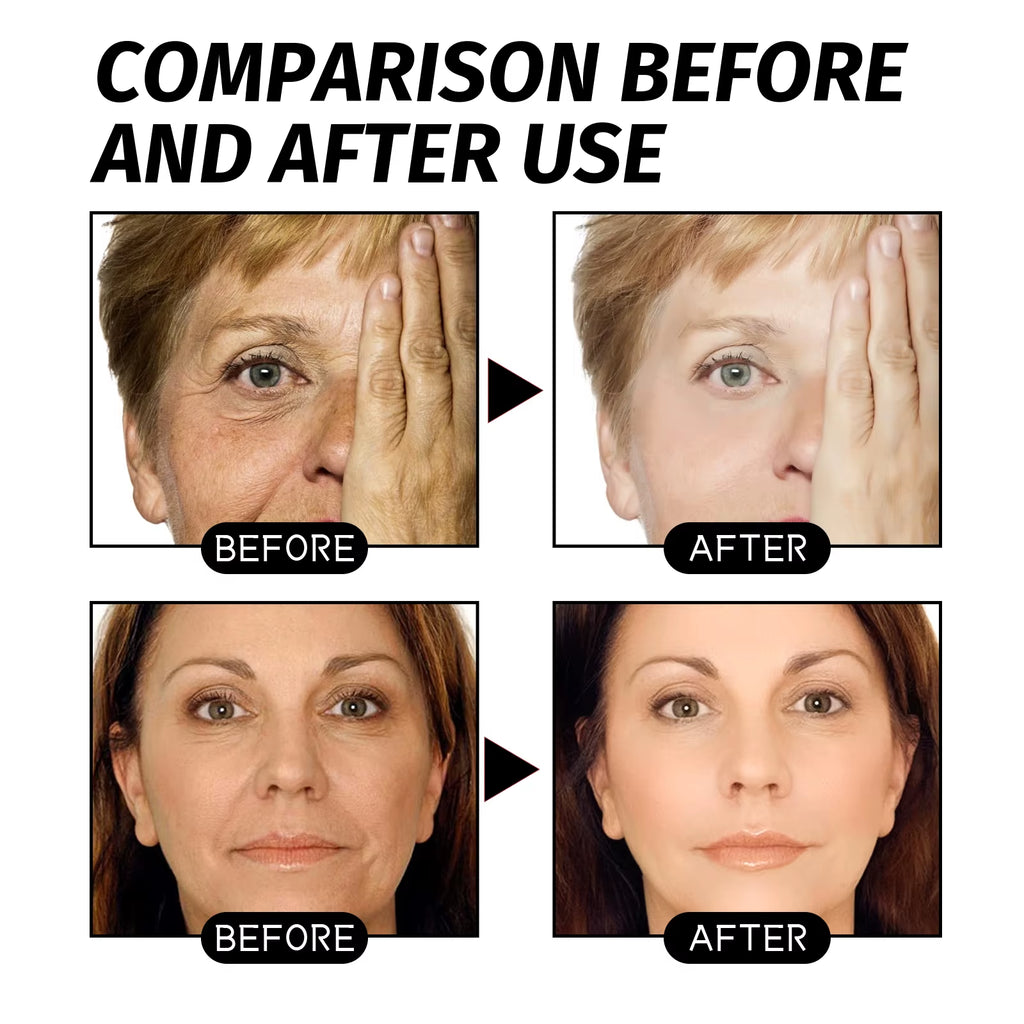 Gold Retinol Snake Venom Peel off Mask Remove Blackheads Deep Cleansing Shrink Pores Moisturizing Facial Mask Skin Care Products