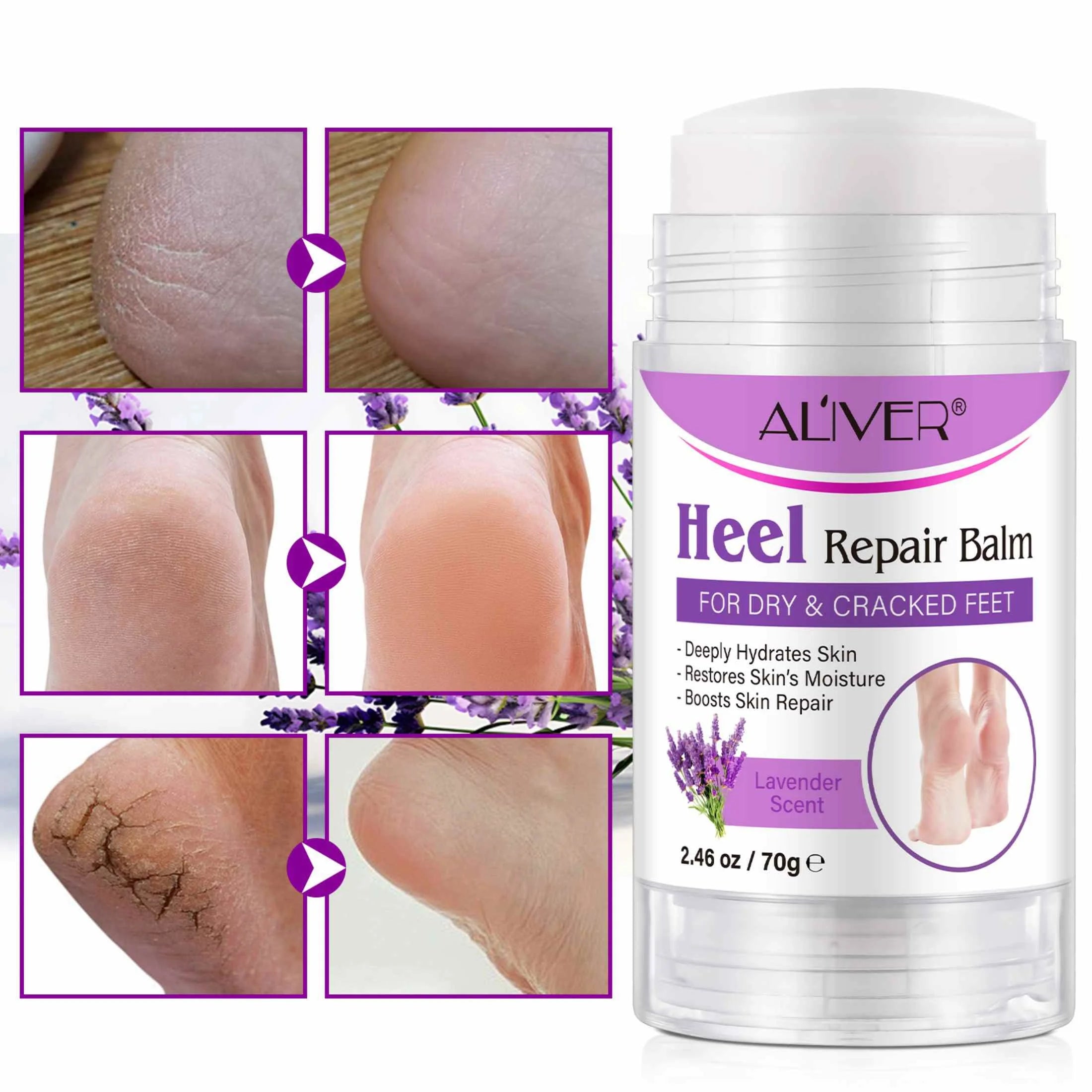 Aliver Cracked Heel Repair Balm, Balm for Rough Heels, for Dry Skin & Cracked Feet Hydration,(Lavender)2.46Oz