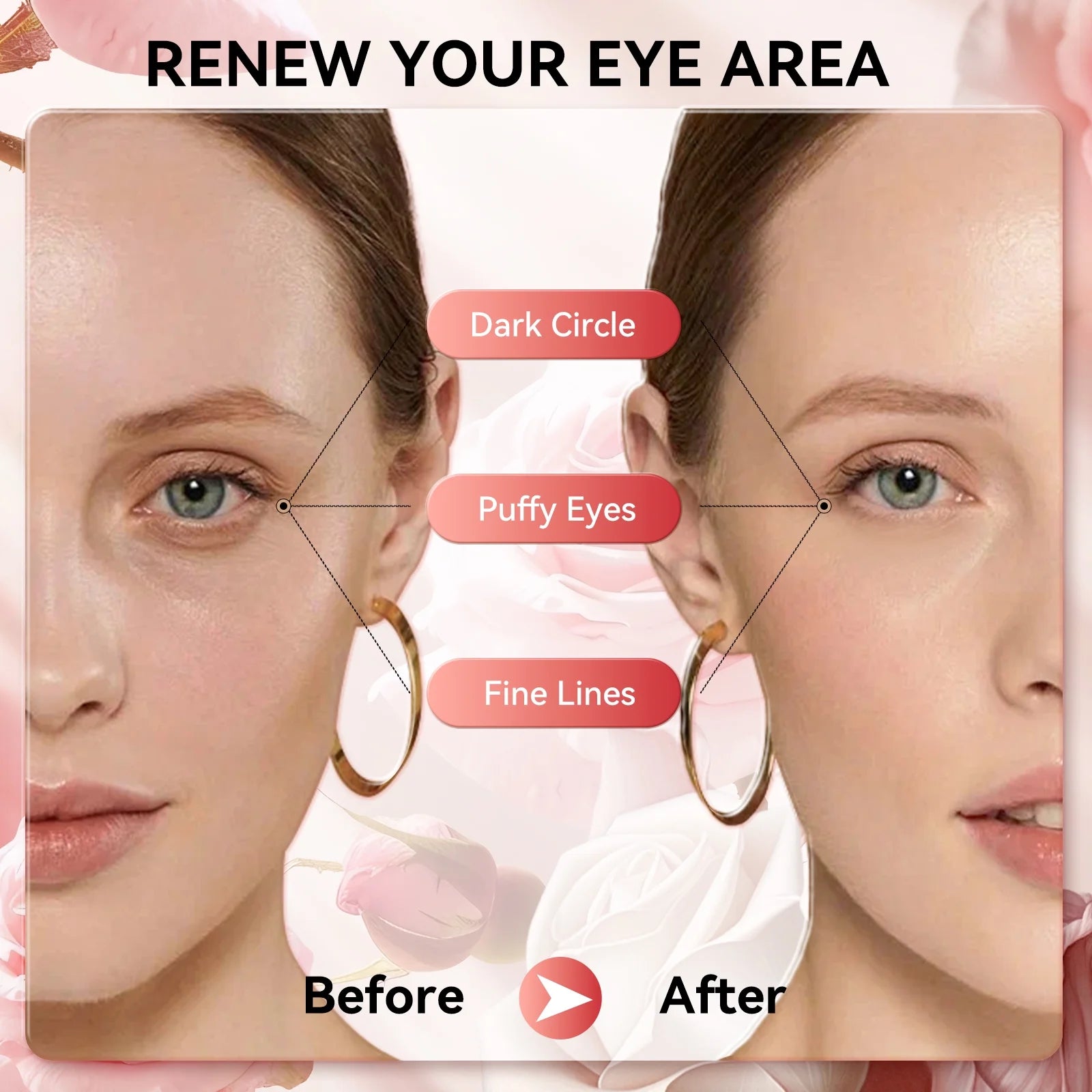 Rose Eye Mask Eye Patches 60 Pcs Puffy Eyes Dark Circles Reduce Wrinkles and Fine Lines Undereye