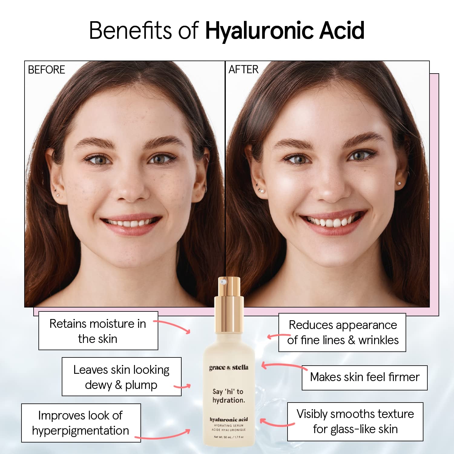 Award Winning Hyaluronic Acid Serum (50Ml/1.7 Fl Oz) Hydrating Hyaluronic Acid Serum for Face - Acido Hialuronico for Women - Remove Fine Lines, Wrinkles, anti Aging - Vegan Skincare