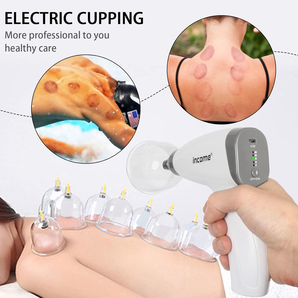 Electric Cupping Therapy Set, Portable Chinese Cupping Therapy Machine with Pump, Electric Body Massage Scraping Care Device Kit with 4 Vacuum Suction Cups for Homeuse