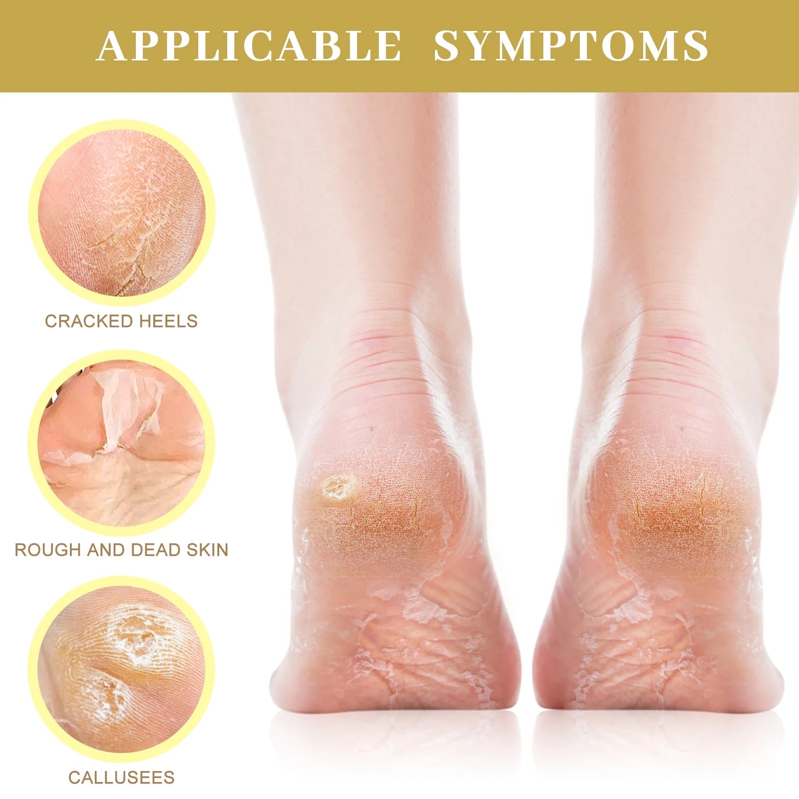 Berlaney Moisturizing Foot Mask with Shea Butter, Moisturizing Foot Mask for Dry and Cracked Feet, Dry Skin Moisturizer for Soft and Smooth Feet