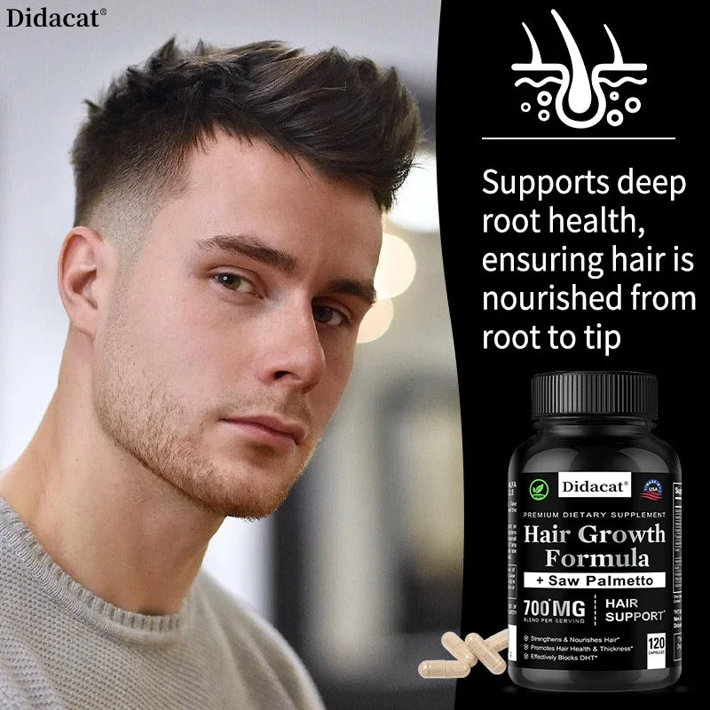 Hair Loss Supplements for Men & Women with Biotin - Saw Palmetto Supplements for Healthy and Strong Hair - Promotes Hair Growth